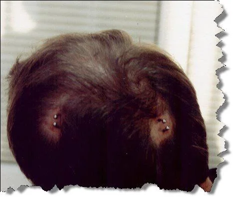 piercing-cerebral